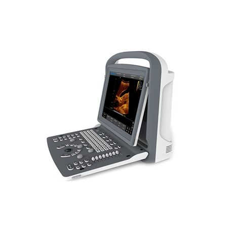 CHISON ECOGRAPH PORTABLE CHISON ECHO1 - SCREEN 12" - KEINE SONDE