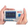 GIMA CEG CARDIO B ALIMENTAÇÃO COM SOFTWARE - 3 DERIVAÇÕES E 17 ANÁLISE