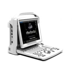 CHISON ECO3 EXPERT - BLANCO NEGRO COM DOPPLER - NÃO SONDA