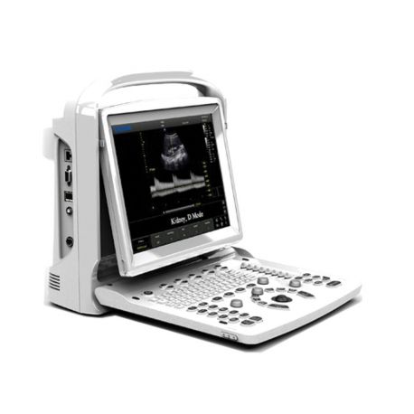 CHISON ECO3 EXPERT - BLANCO NEGRO COM DOPPLER - NÃO SONDA
