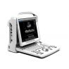 CHISON ECOGRAPH PORTABLE CHISON ECO3 EXPERT - BLANC NOIR AVEC DOPPLER - PAS DE SONDE