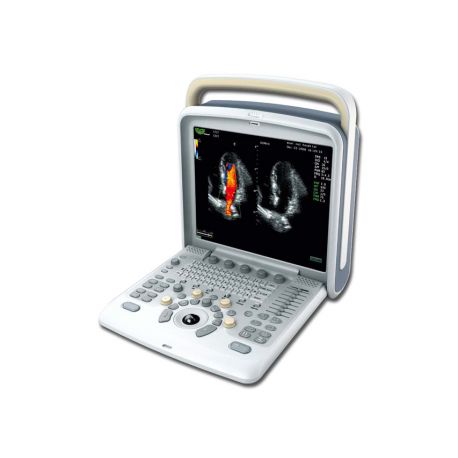 CHISON CHISON Q5 COLOR - DOPPLER - NO SONDA