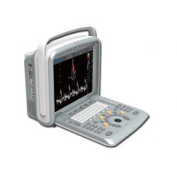 CHISON PORTABLE ECOGRAPH CHISON Q9 + 4D COLOR - DOPPLER - PAS DE SONDE