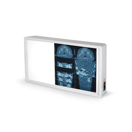 GIMA NGATOSCOPIO DE 38X62CM