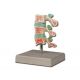 ALTAY MODELO DE PATOLOGÍA OSTEOPOROSIS AVANZADA