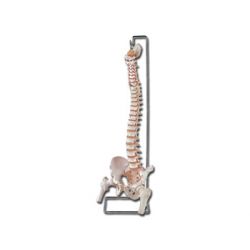 GIMA COLUMNA VERTEBRAL - MIT FEMORAL CABEZS UND ABIERTO